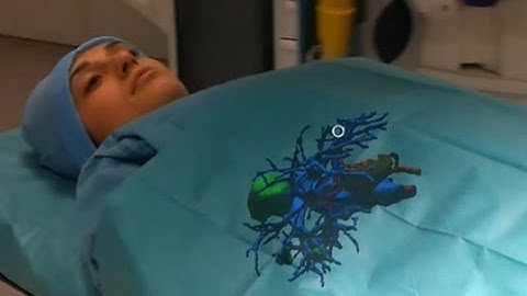 IRCAD-IHU Augmented Reality using Microsoft Hololens