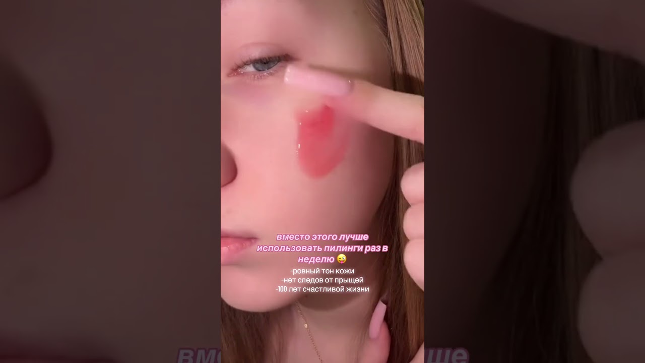 ни за что не давим!! 