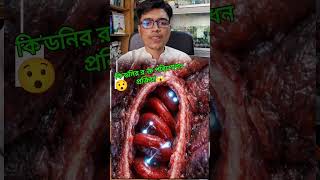 The process by which the kidneys make urine🤔#shorts #shortvideo #health #trending #ytshorts #ytviral