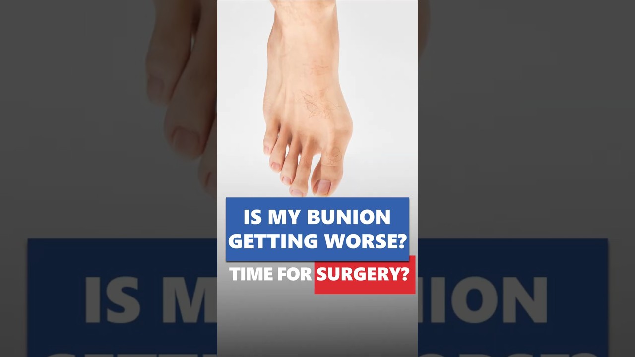 Why Bunions Get Worse Over Time? | How to Fix Bunions Fast