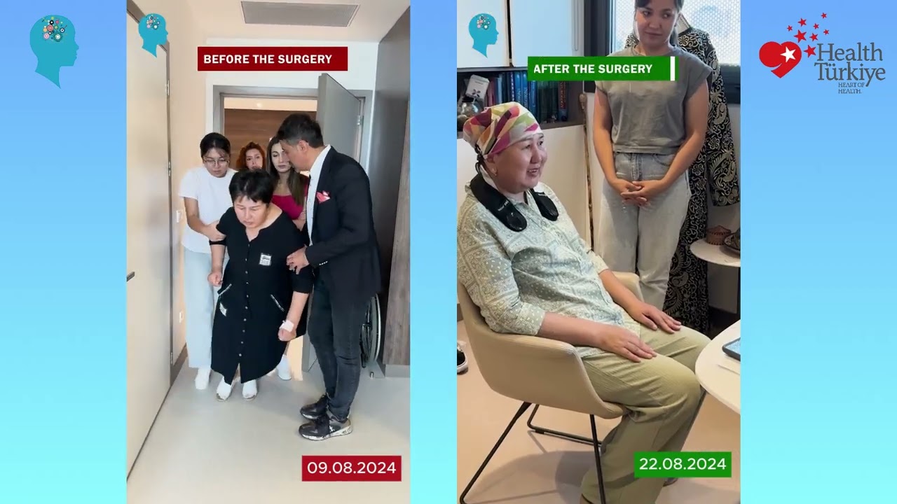 From Immobility to Independence: DBS for Parkinson's