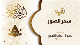 رقية سحر الصور باذن الله -  الشيخ ناصر آل زيدان الغامدي -