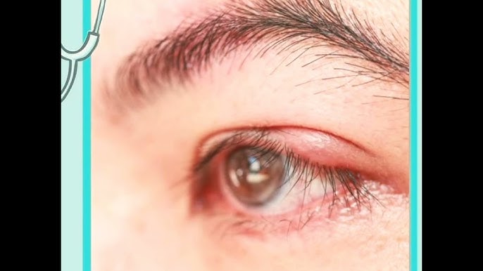 Жабық басы бар еркек жыныс мүшесі Марина Александрова көше жарыс секс