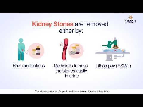 Kidney Stone Removal | Kidney Stone: Causes, Signs, and Treatment Methods