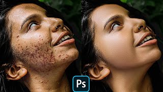 Advance High Level Skin Retouching in Photoshop | Remove Acne,  - اردو / हिंदी