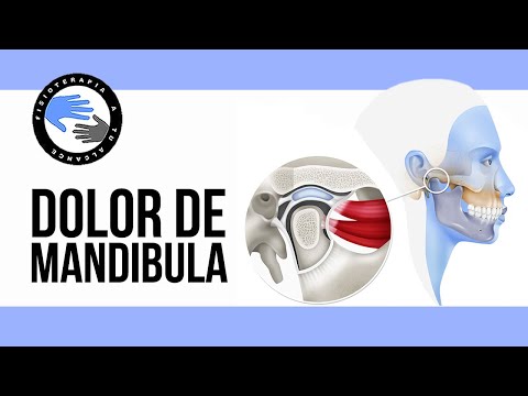 Vídeo: Dolor De Mandíbula En Un Lado: 6 Causas, Consejos De Alivio, Cuándo Ver A Un Médico