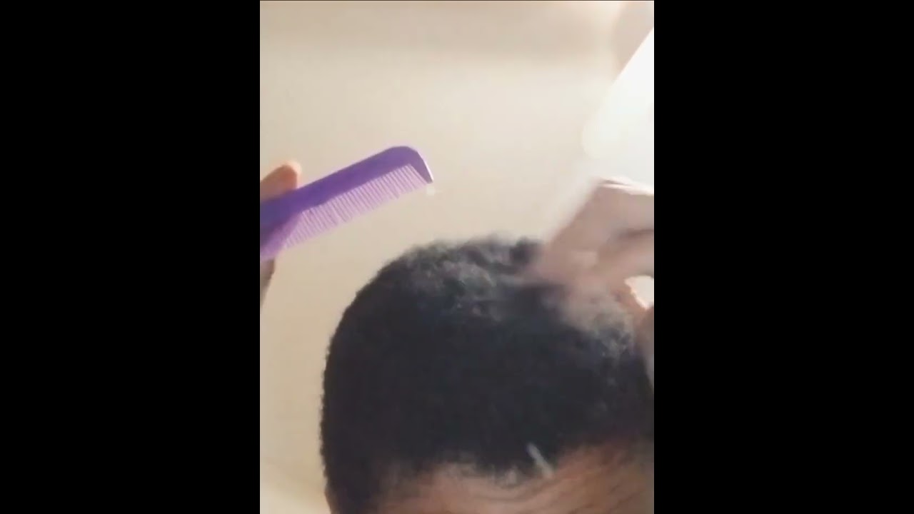 Dandruff Removal/Unlimited Flakes (with sound)