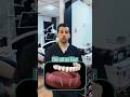All-on-Four Dental Implants with Dr. Behbahani: A Life-Changing Procedure