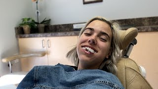 WISDOM TEETH VLOG | joanna simon