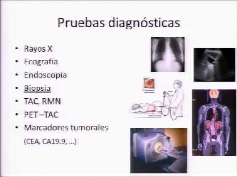 Vídeo: Diferencia Entre Diagnóstico Y Pronóstico