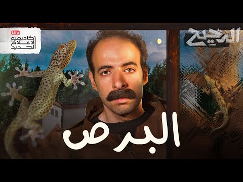 فيديو البرص | الدحيح