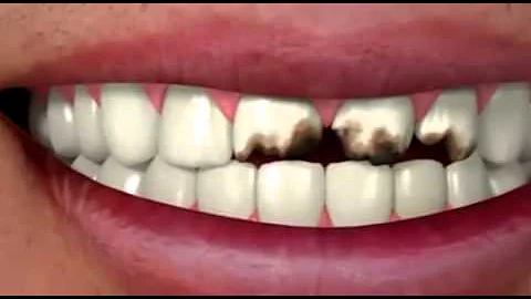 mexican dental tourism
