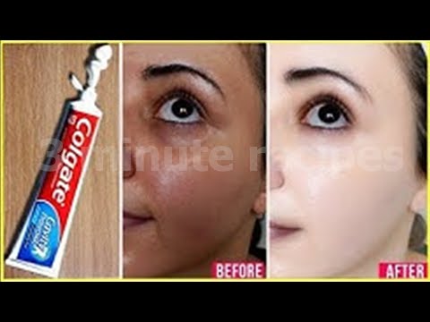 Skin Whitening Colgate Toothpaste At Home Remedies  Lifestyle Tips