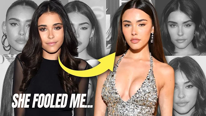 NEW Madison Beer Plastic Surgery Update:: What I D...