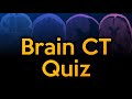 Brain ct quiz challenge