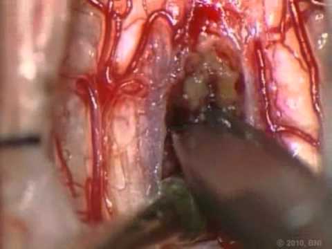 NEUROSURGERY Journal
