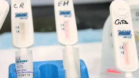 FDA Approves HIV Test