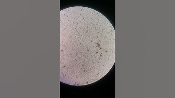 Direct Saline and Iodine Wet Mount of Stool #laboratory #medtechstudent #fecalysis #stoolanalysis