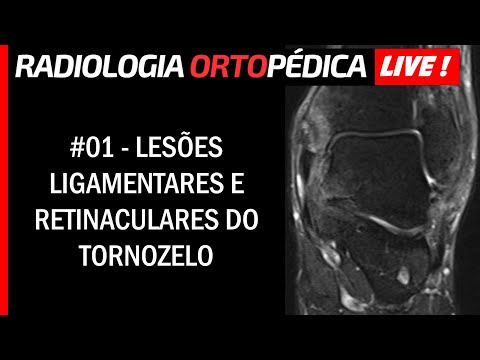 Vídeo: O que é sistema retinacular?