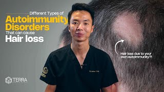 Different Types of Autoimmunity Disorders That Can Cause Hair Loss - Hair Talks by Terra Medical