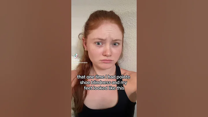 POINTE SHOE BLINDNESS 😭 #ballet #ballerina #pointe #pointeshoes