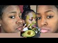 Kuondoa CHUNUSI Usoni Na MAKOVU Kwa Haraka How To Get Rid Of Acne In A WEEK Kuondoa CHUNUSI Usoni Na MAKOVU Kwa Haraka How To Get Rid Of Acne In A WEEK