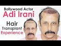 Bollywood Actor Adi Irani Shares Hair Transplant Experience with Dr Suneet Soni | Medispa India