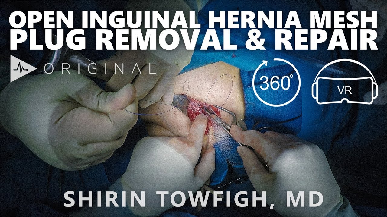 Groin Hernia Repair Colorectal Surgeons Sydney