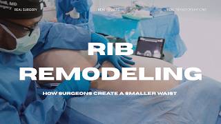 Rib Remodeling Surgery Explained | How Surgeons Create a Smaller Waist | Dr. Andre Marshall