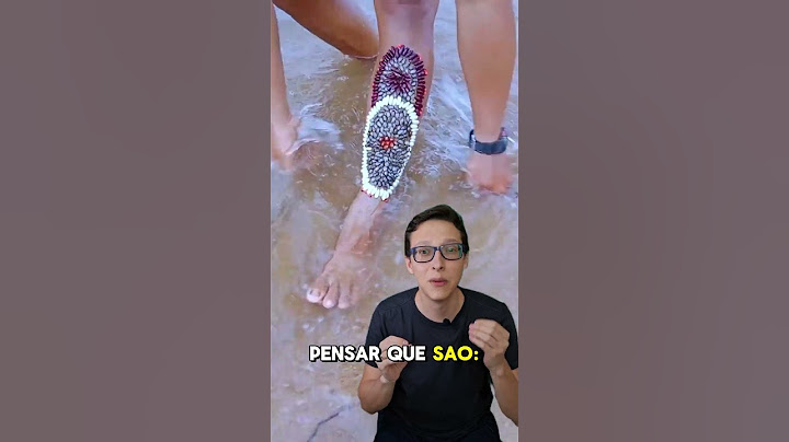 O que é isso? 🤔😯#medico #enfermagem #curiosidades  #enfermeira