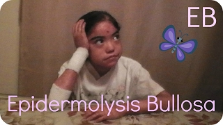 THE WORST DISEASE YOU'VE NEVER HEARD OF