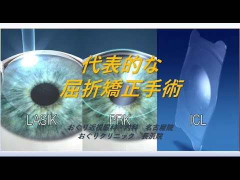 代表的な屈折矯正手術　おぐり近視眼科・内科 名古屋院   おぐりクリニック 長浜院