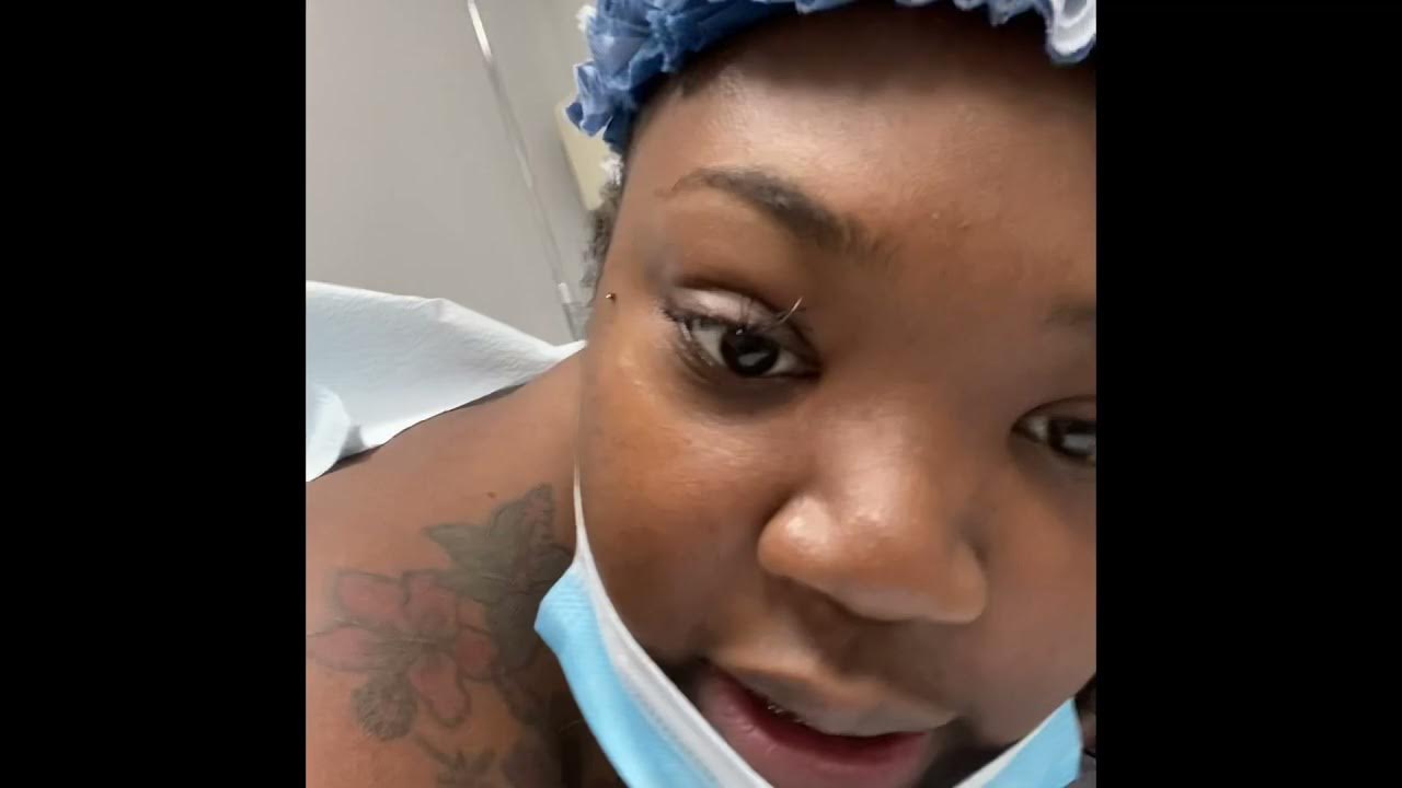 360 Lipo And Bbl In Dominican Republic BBL Journey for 360 LIPO & BBL with Dr Fasusi at Mia Aesthetic the real