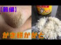 【成長かかと・前編】乾燥大敵！大量角質取れました。自宅フットケア今宵も主人に尽くします笑