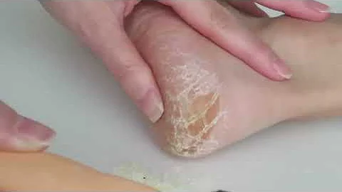 تحميل 足裏角質 تحميل 足裏角質