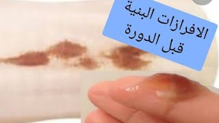 علامات الحمل الواضحه سبب نزول دم بنى ايام التبويض أو بعد التبويض قبل الدوره  هل حمل?