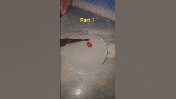 Starch Hydrolysis Test Microbioloy 🧡