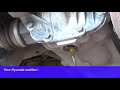 Hyundai Differential Service | Boyer Hyundai