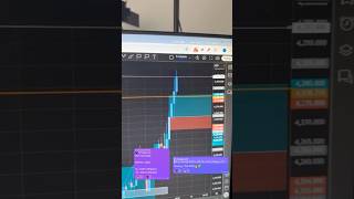 Download Lagu GOLD BUYS MADE ME $15,000 ALL IN 60 MINUTES 😮 MP3 Download Lagu GOLD BUYS MADE ME $15,000 ALL IN 60 MINUTES 😮 MP3