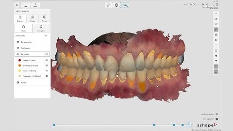 TRIOS 6, TRIOS Dx Plus software and the DentalHealth app work together in a real patient visit