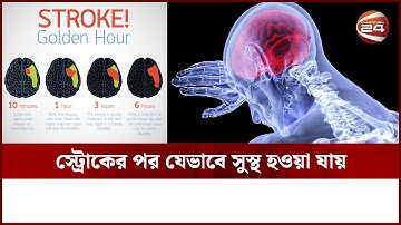 স্ট্রোকের পর যেভাবে সুস্থ হওয়া যায় | Stroke Treatment | Channel 24