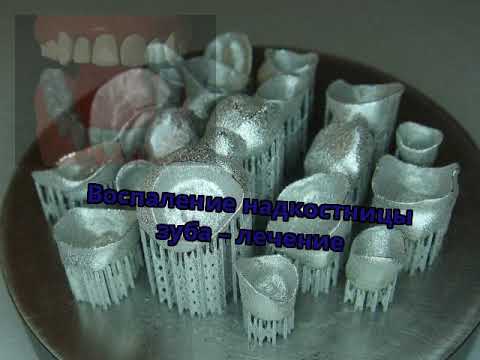 Воспаление надкостницы зуба лечение в домашних условиях