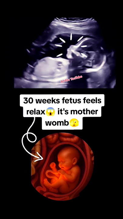 Fetus feels relax🫣 at 30 weeks it's mother womb gender?🤫|#pregnancy #baby