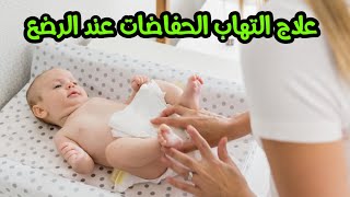 علاج التهاب الحفاضات عند الاطفال الرضع و حديثي الولادة بسرعة مذهلة و افضل طرق الوقاية للرضع
