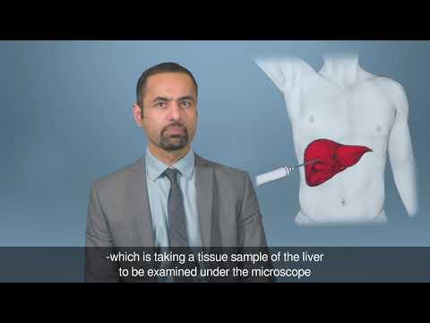 Primary Sclerosing Cholangitis