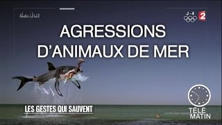 Santé - Les gestes qui sauvent - 2016/08/01 Santé - Les gestes qui sauvent - 2016/08/01