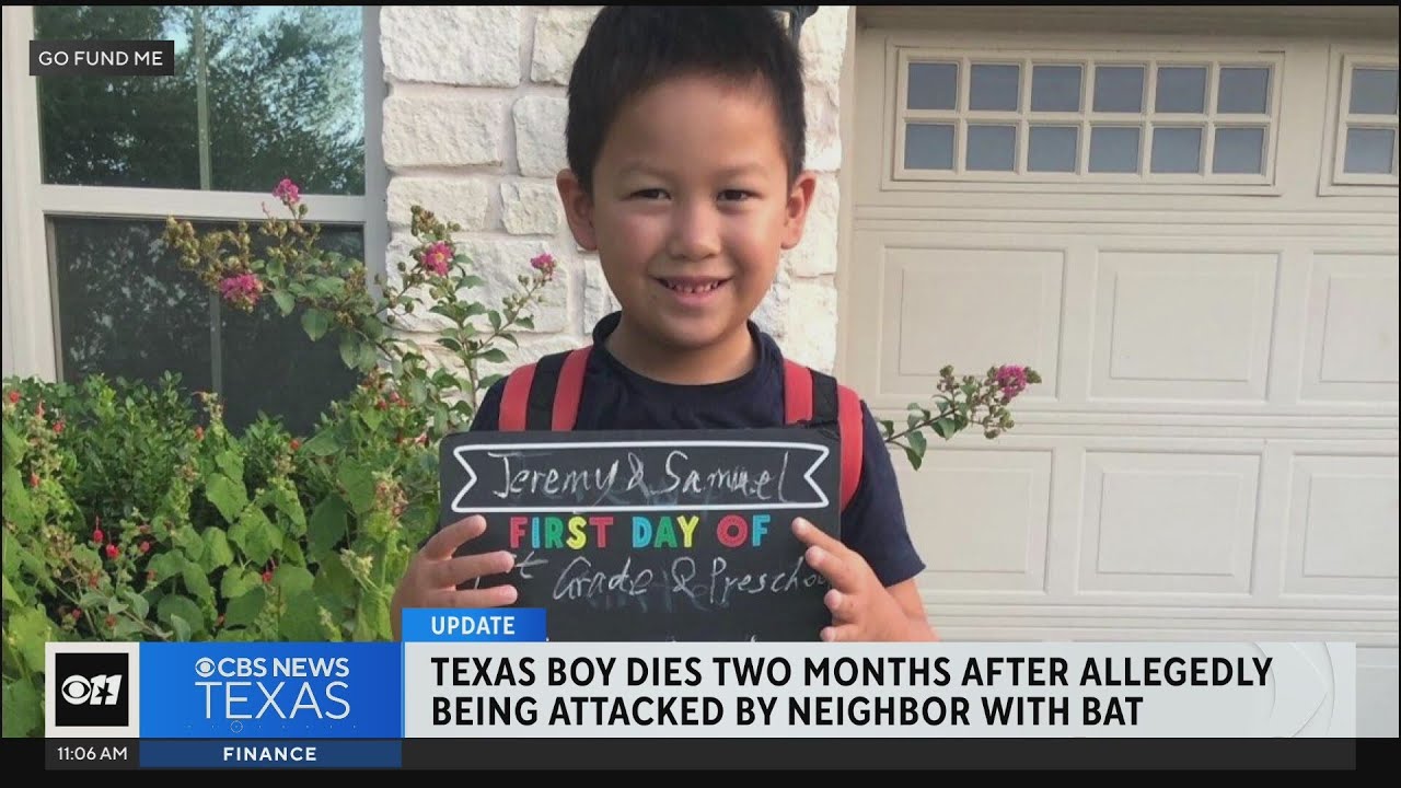 Texas boy dies 2 months after being attacked by bat