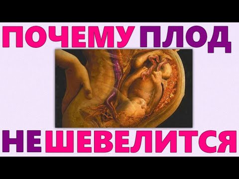 ОТСУТСТВУЮТ ШЕВЕЛЕНИЯ ПЛОДА ВО ВРЕМЯ БЕРЕМЕННОСТИ | Что делать если  ребенок стал мало шевелиться
