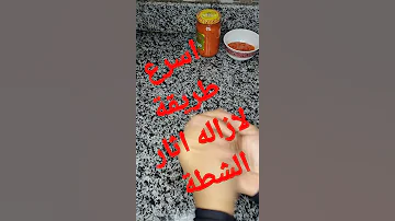 إزالة آثار الفلفل الحار من اليدين 
