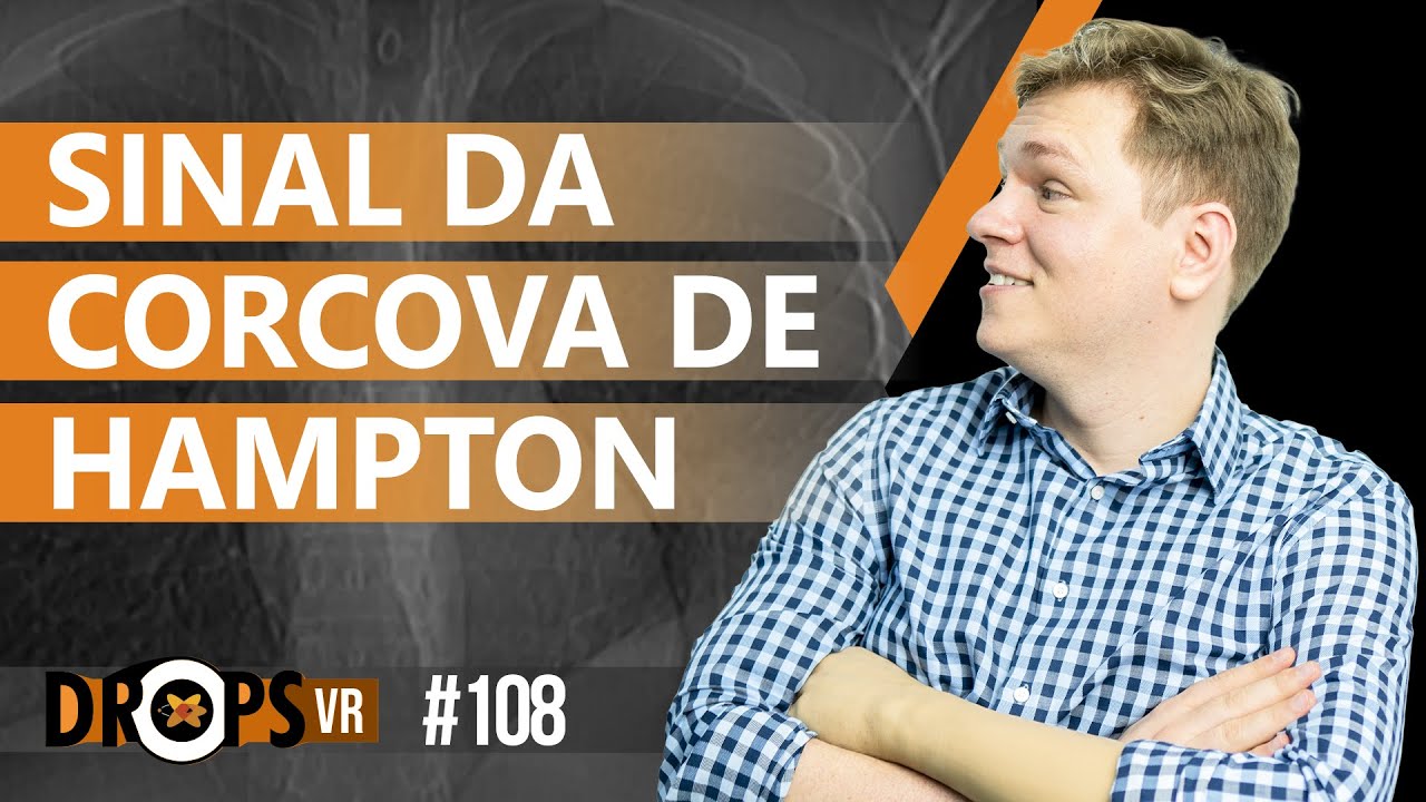 SINAL DA CORCOVA DE HAMPTON VOCÊ SABE IDENTIFICAR? YouTube SINAL DA CORCOVA DE HAMPTON VOCÊ SABE IDENTIFICAR? YouTube